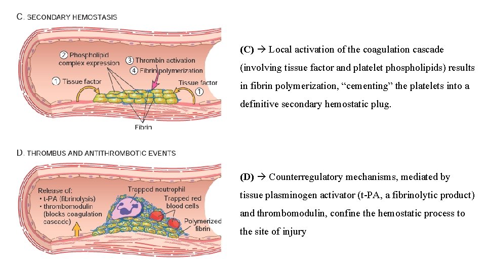 (C) Local activation of the coagulation cascade (involving tissue factor and platelet phospholipids) results
