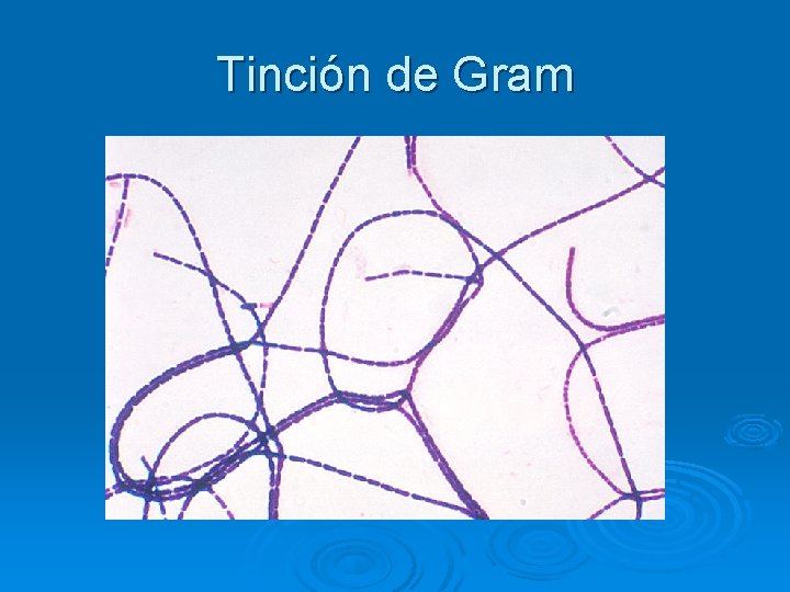 Tinción de Gram 