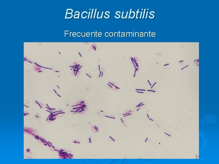 Bacillus subtilis Frecuente contaminante 