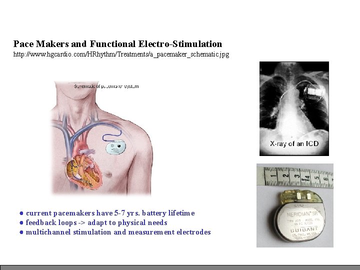 Pace Makers and Functional Electro-Stimulation http: //www. hgcardio. com/HRhythm/Treatments/a_pacemaker_schematic. jpg ● current pacemakers have