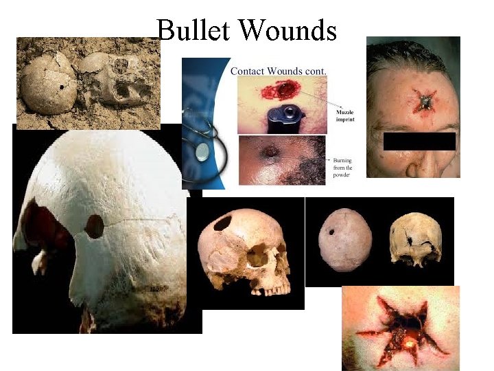 Bullet Wounds 