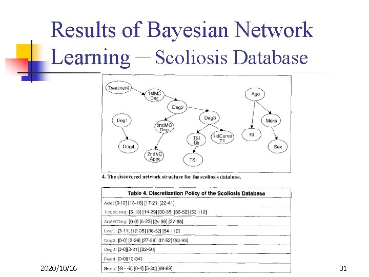 Results of Bayesian Network Learning－Scoliosis Database 2020/10/26 31 