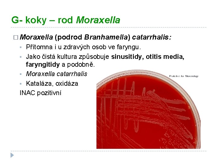G- koky – rod Moraxella � Moraxella (podrod Branhamella) catarrhalis: Přítomna i u zdravých