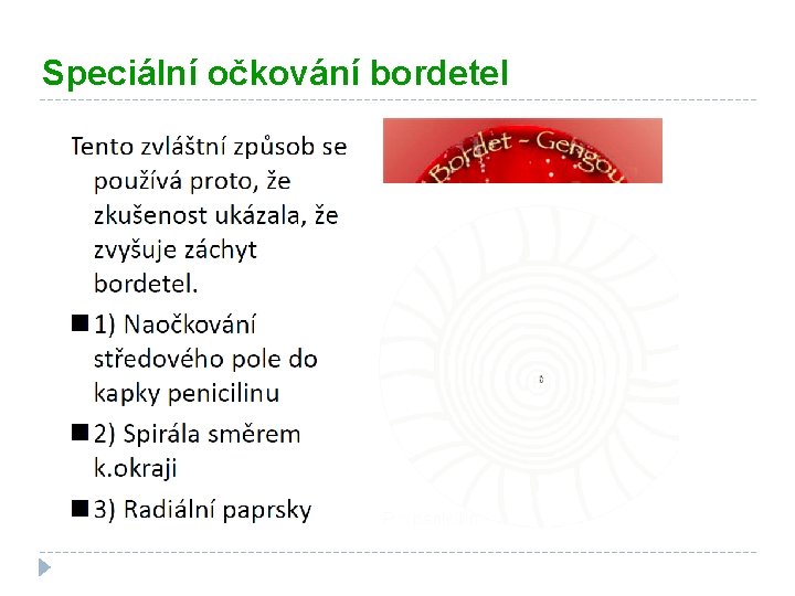 Speciální očkování bordetel 