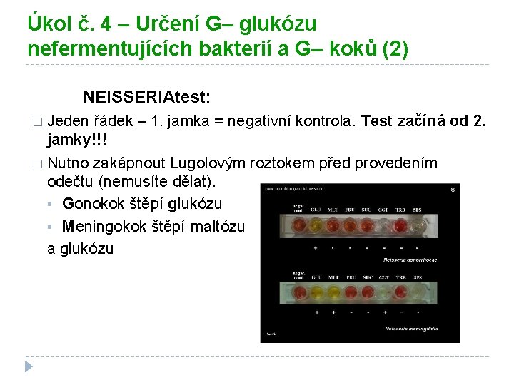 Úkol č. 4 – Určení G– glukózu nefermentujících bakterií a G– koků (2) NEISSERIAtest: