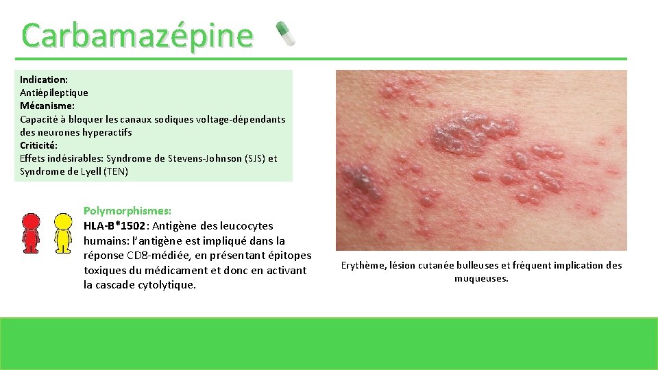 Carbamazépine Indication: Antiépileptique Mécanisme: Capacité à bloquer les canaux sodiques voltage-dépendants des neurones hyperactifs