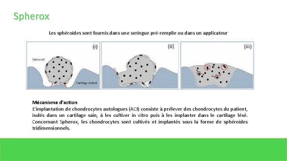 Spherox Les sphéroïdes sont fournis dans une seringue pré-remplie ou dans un applicateur Mécanisme