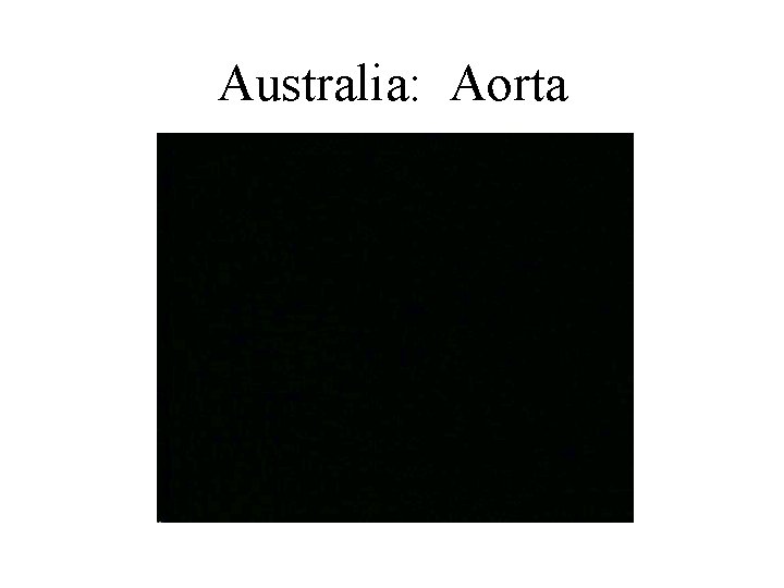 Australia: Aorta 