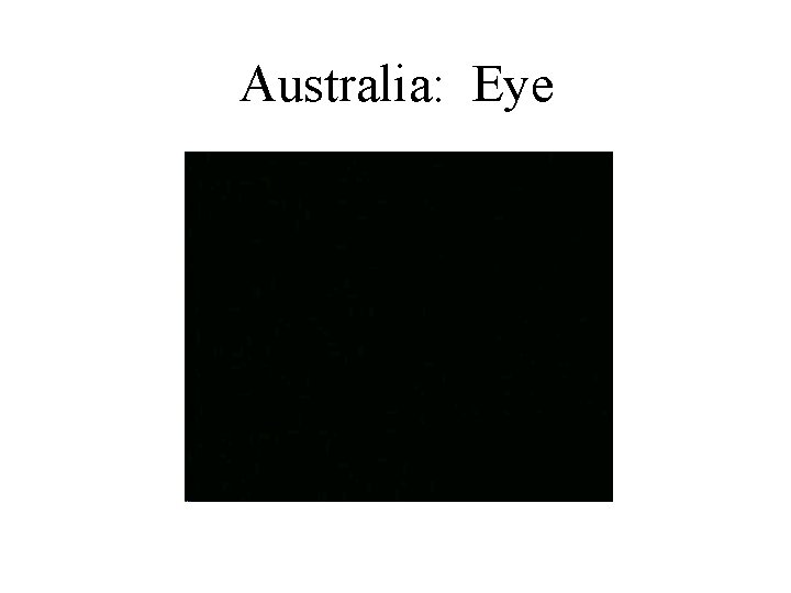 Australia: Eye 