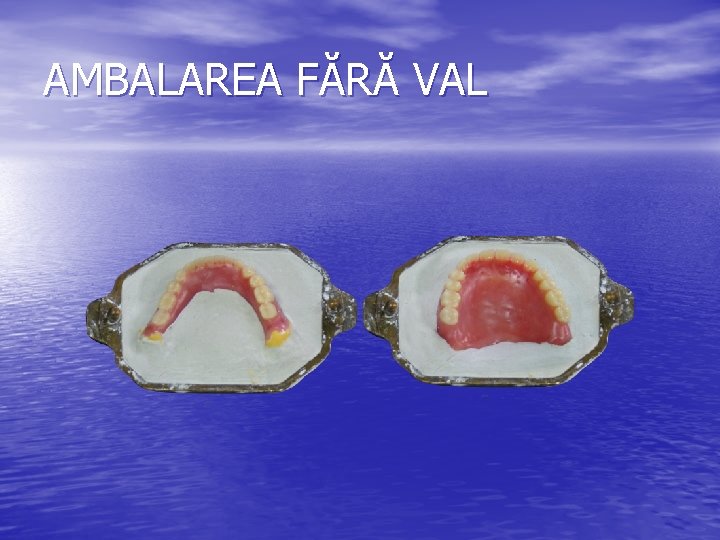 AMBALAREA FĂRĂ VAL 