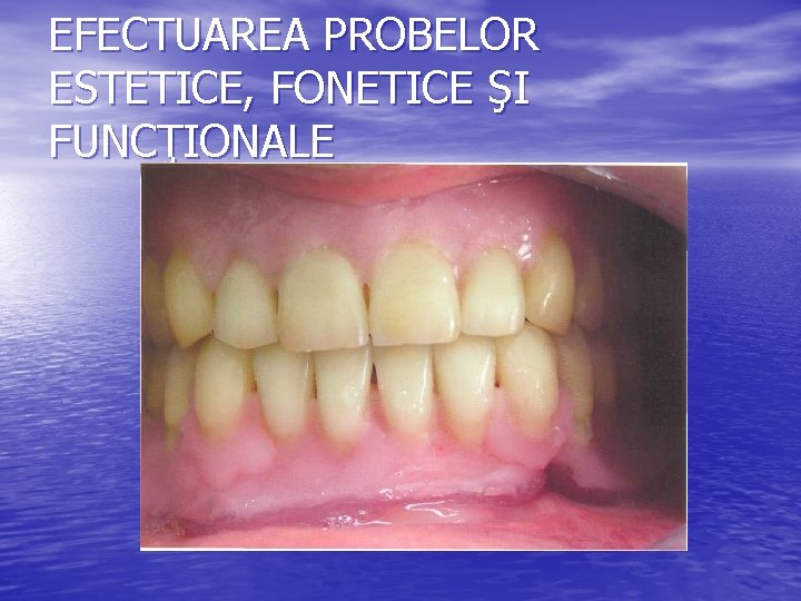 EFECTUAREA PROBELOR ESTETICE, FONETICE ŞI FUNCŢIONALE 