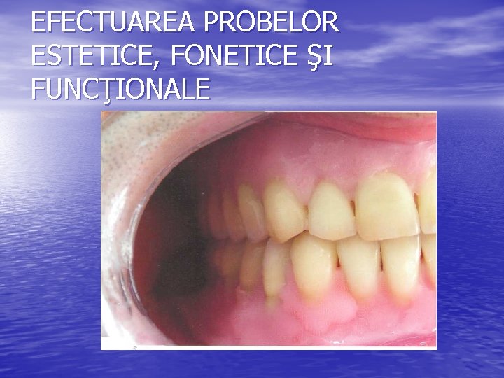 EFECTUAREA PROBELOR ESTETICE, FONETICE ŞI FUNCŢIONALE 