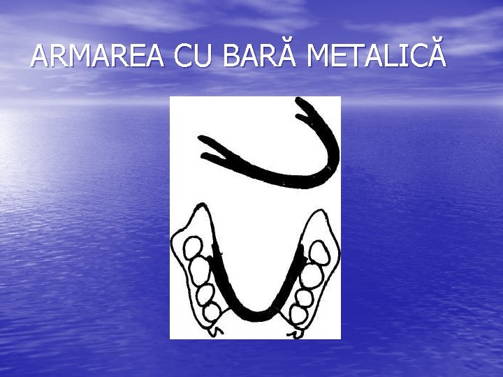 ARMAREA CU BARĂ METALICĂ 