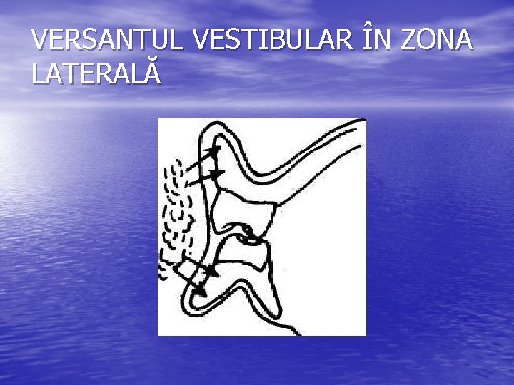 VERSANTUL VESTIBULAR ÎN ZONA LATERALĂ 