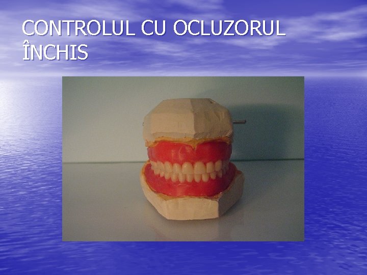 CONTROLUL CU OCLUZORUL ÎNCHIS 