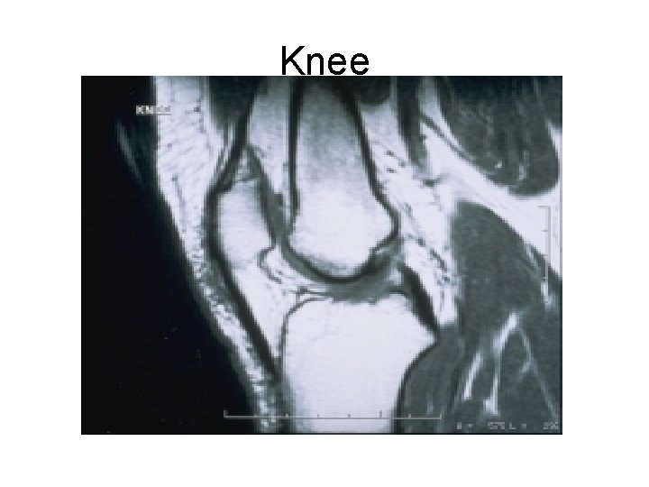 Knee 