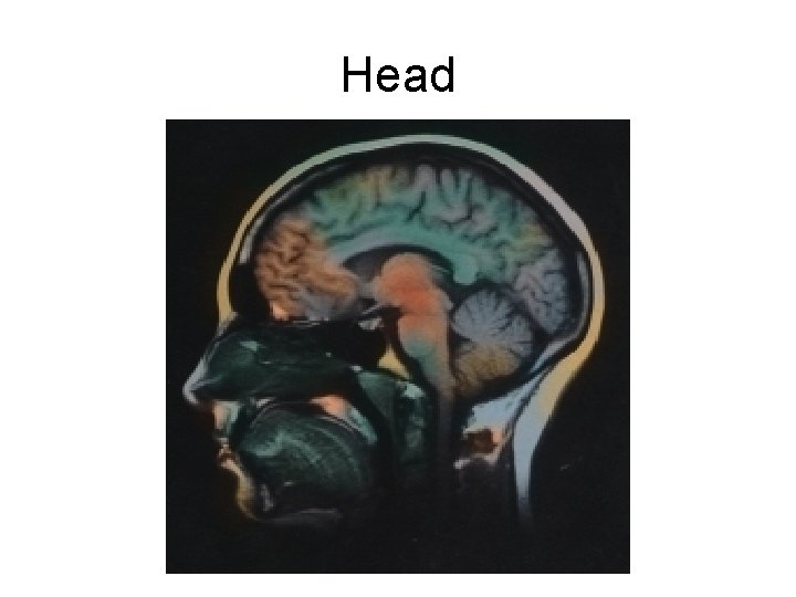 Head 