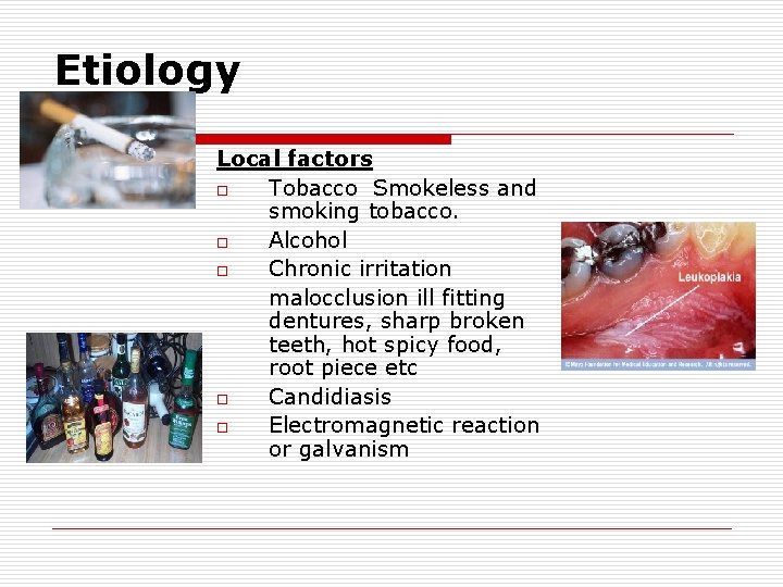 Etiology Local factors o Tobacco Smokeless and smoking tobacco. o Alcohol o Chronic irritation
