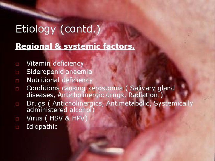 Etiology (contd. ) Regional & systemic factors. o o o o Vitamin deficiency Sideropenic