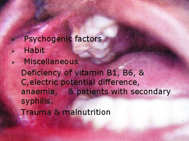 Ø Ø Ø Psychogenic factors Habit Miscellaneous Deficiency of vitamin B 1, B 6,