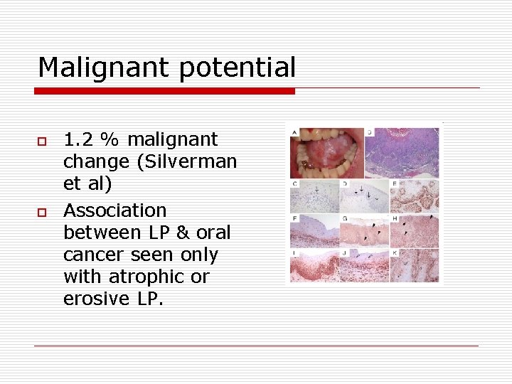 Malignant potential o o 1. 2 % malignant change (Silverman et al) Association between