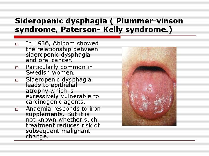 Sideropenic dysphagia ( Plummer-vinson syndrome, Paterson- Kelly syndrome. ) o o In 1936, Ahlbom