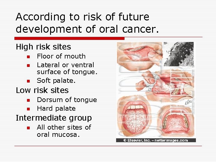 According to risk of future development of oral cancer. High risk sites n n