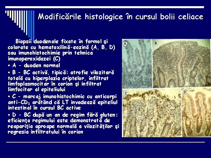 Modificările histologice în cursul bolii celiace Biopsii duodenale fixate în formol şi colorate cu