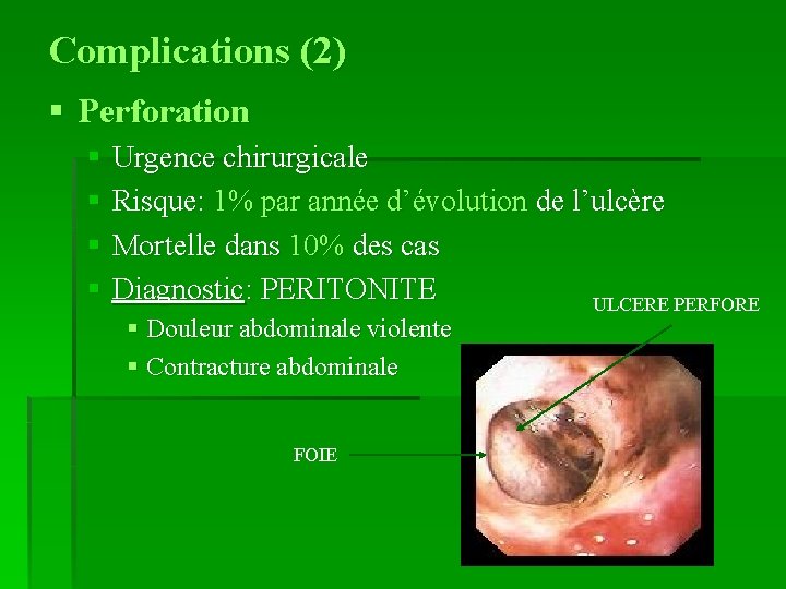 Complications (2) § Perforation § Urgence chirurgicale § Risque: 1% par année d’évolution de