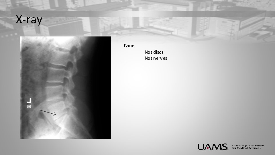 X-ray Bone Not discs Not nerves 