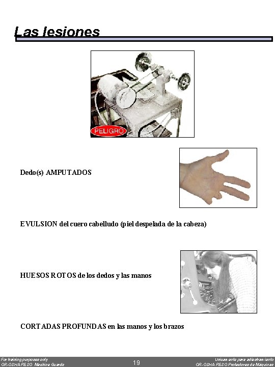 Las lesiones Dedo(s) AMPUTADOS EVULSION del cuero cabelludo (piel despelada de la cabeza) HUESOS