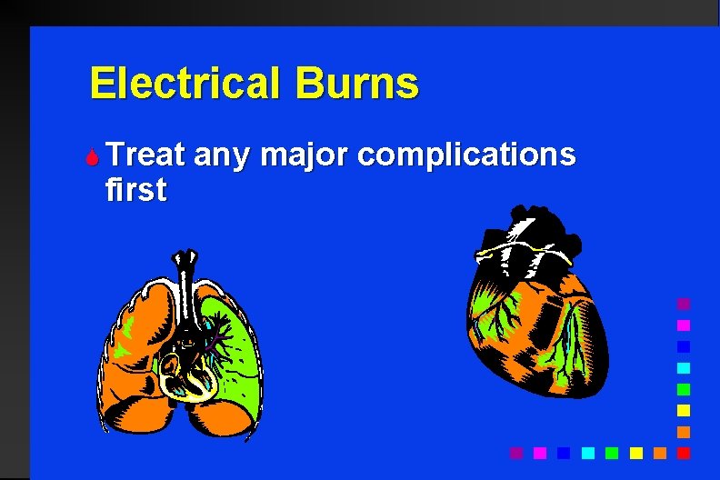 Electrical Burns S Treat first any major complications 