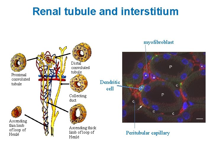 Renal tubule and interstitium myofibroblast Proximal convoluted tubule Distal convoluted tubule Dendritic cell Collecting
