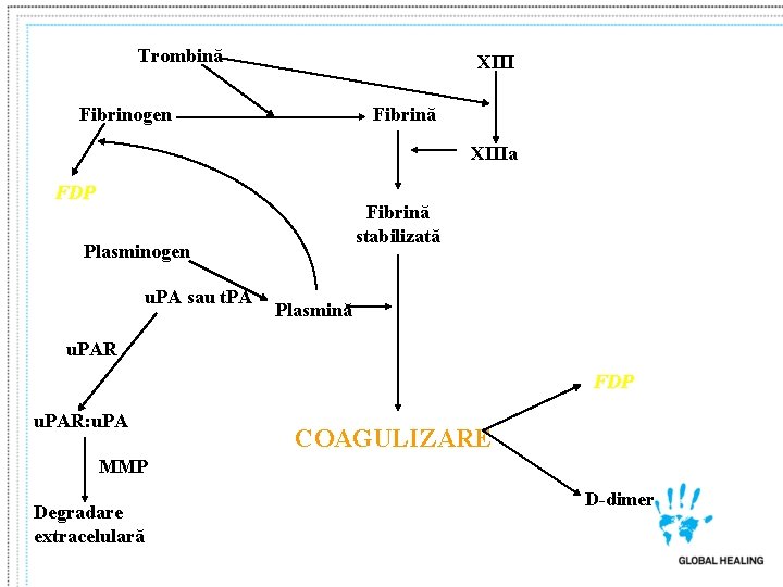 Trombină XIII Fibrinogen Fibrină XIIIa FDP Fibrină stabilizată Plasminogen u. PA sau t. PA