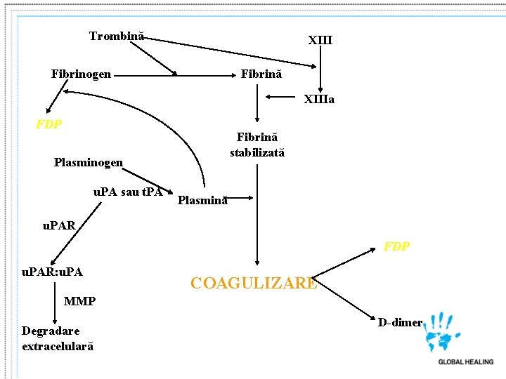 Trombină XIII Fibrinogen Fibrină XIIIa FDP Fibrină stabilizată Plasminogen u. PA sau t. PA Trombină XIII Fibrinogen Fibrină XIIIa FDP Fibrină stabilizată Plasminogen u. PA sau t. PA