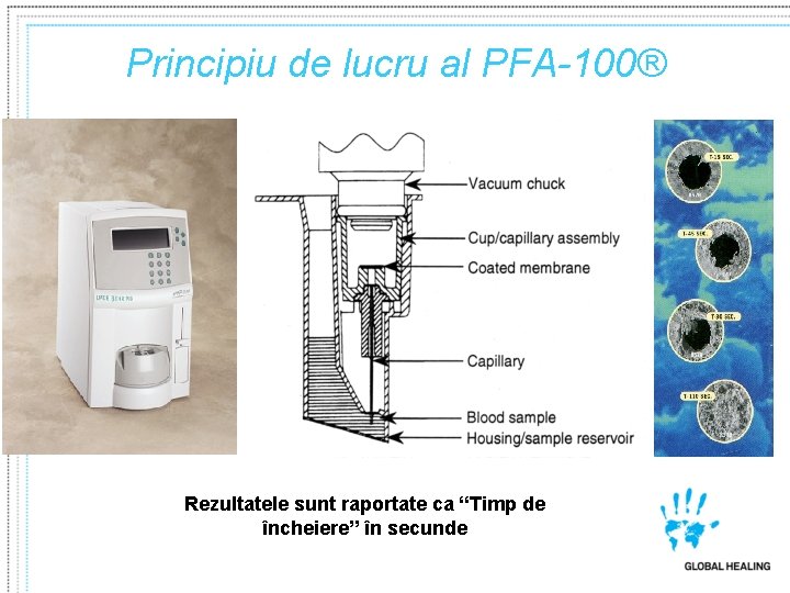 Principiu de lucru al PFA-100® Rezultatele sunt raportate ca “Timp de încheiere” în secunde Principiu de lucru al PFA-100® Rezultatele sunt raportate ca “Timp de încheiere” în secunde
