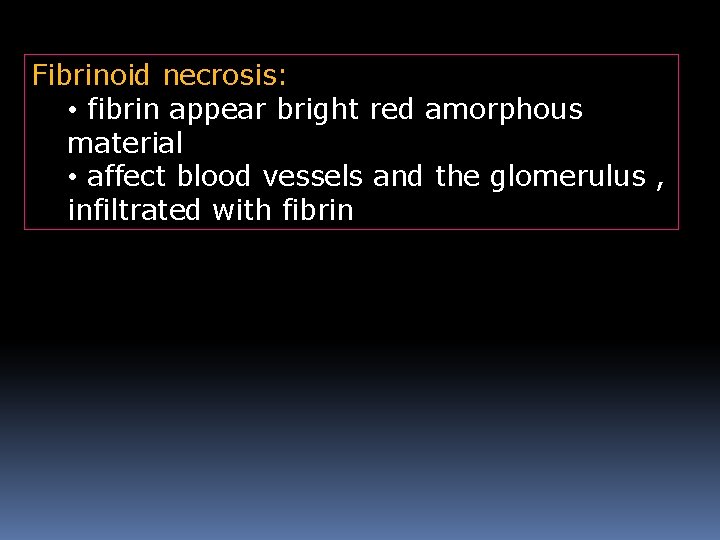 Fibrinoid necrosis: • fibrin appear bright red amorphous material • affect blood vessels and