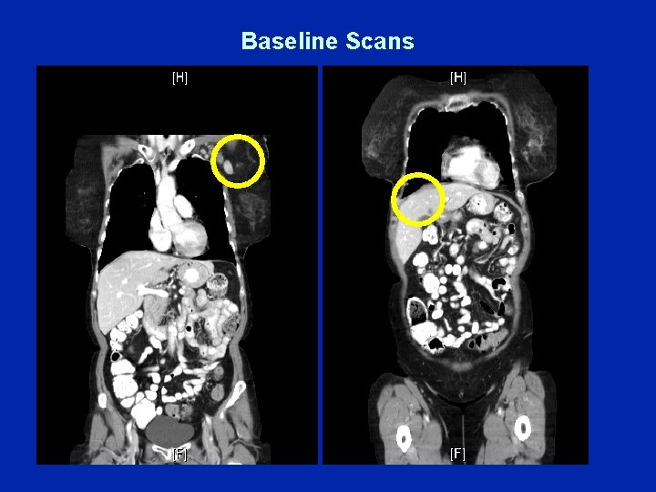 Baseline Scans 