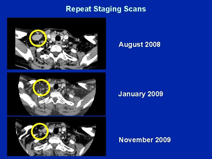 Repeat Staging Scans August 2008 January 2009 November 2009 