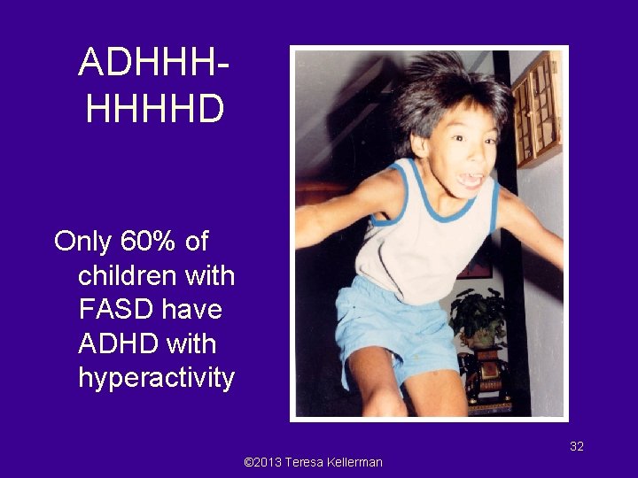 ADHHHHHHHD Only 60% of children with FASD have ADHD with hyperactivity 32 © 2013
