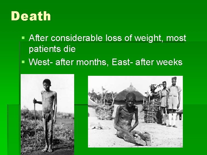Death § After considerable loss of weight, most patients die § West- after months,