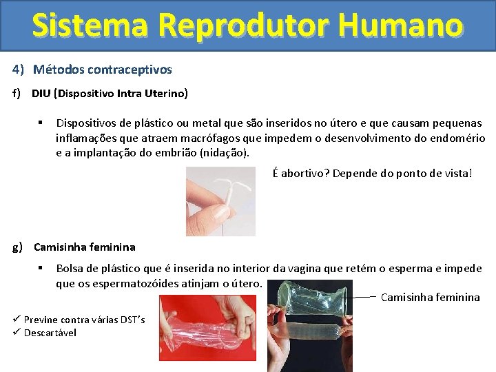 Sistema Reprodutor Humano 4) Métodos contraceptivos f) DIU (Dispositivo Intra Uterino) § Dispositivos de