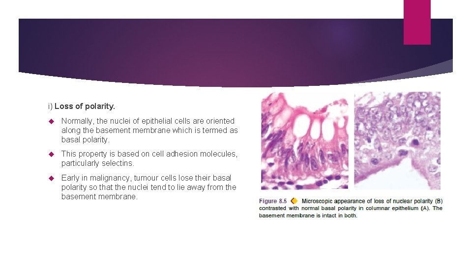 i) Loss of polarity. Normally, the nuclei of epithelial cells are oriented along the