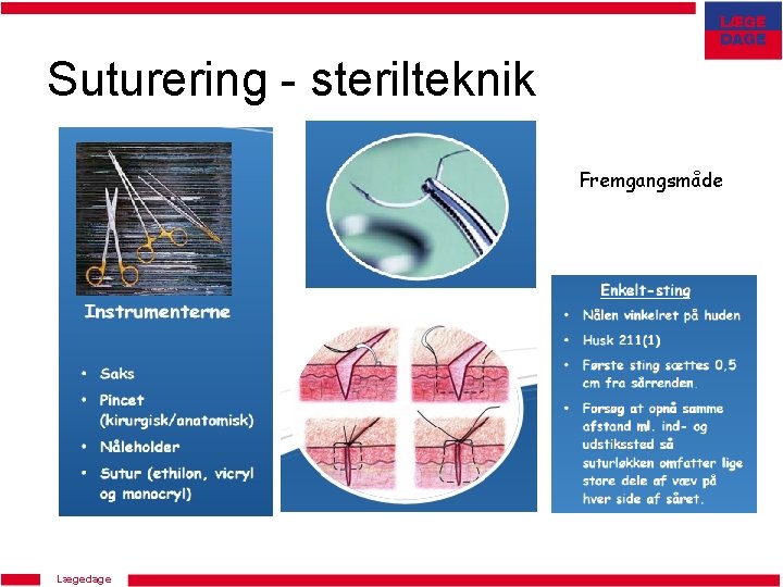 Suturering - sterilteknik Fremgangsmåde Lægedage 