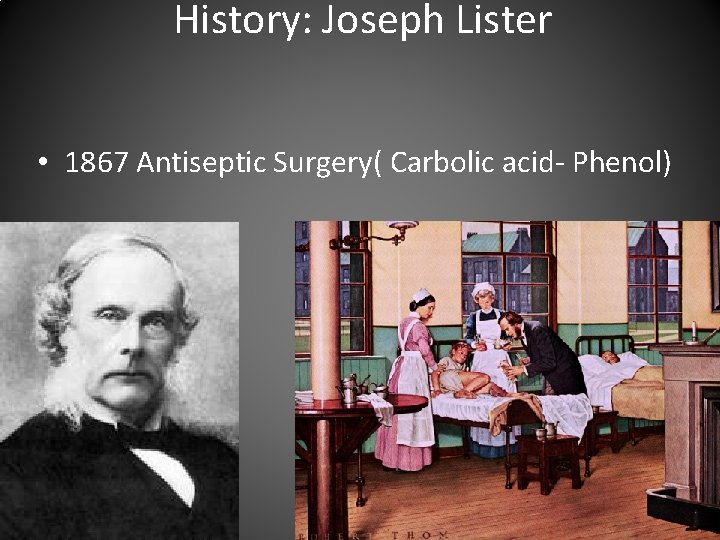 History: Joseph Lister • 1867 Antiseptic Surgery( Carbolic acid- Phenol) 