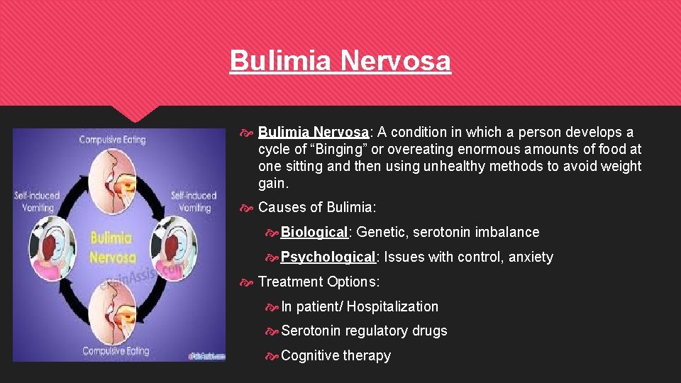 Bulimia Nervosa Bulimia Nervosa: A condition in which a person develops a cycle of