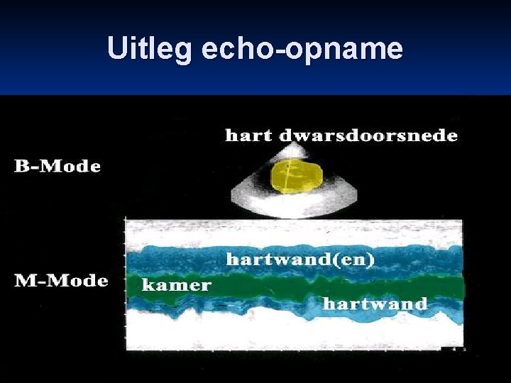 Uitleg echo-opname 