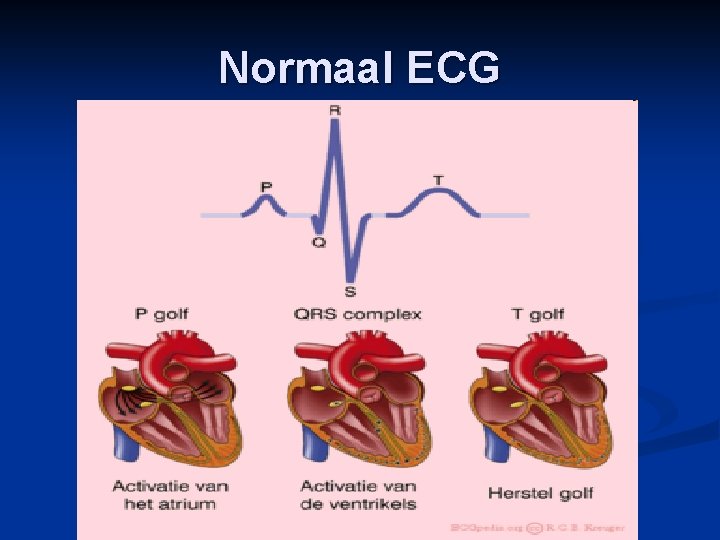 Normaal ECG 