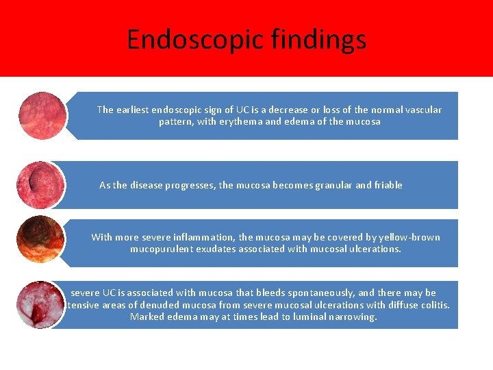 Endoscopic findings The earliest endoscopic sign of UC is a decrease or loss of
