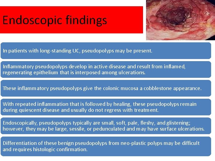 Endoscopic findings In patients with long-standing UC, pseudopolyps may be present. Inflammatory pseudopolyps develop Endoscopic findings In patients with long-standing UC, pseudopolyps may be present. Inflammatory pseudopolyps develop